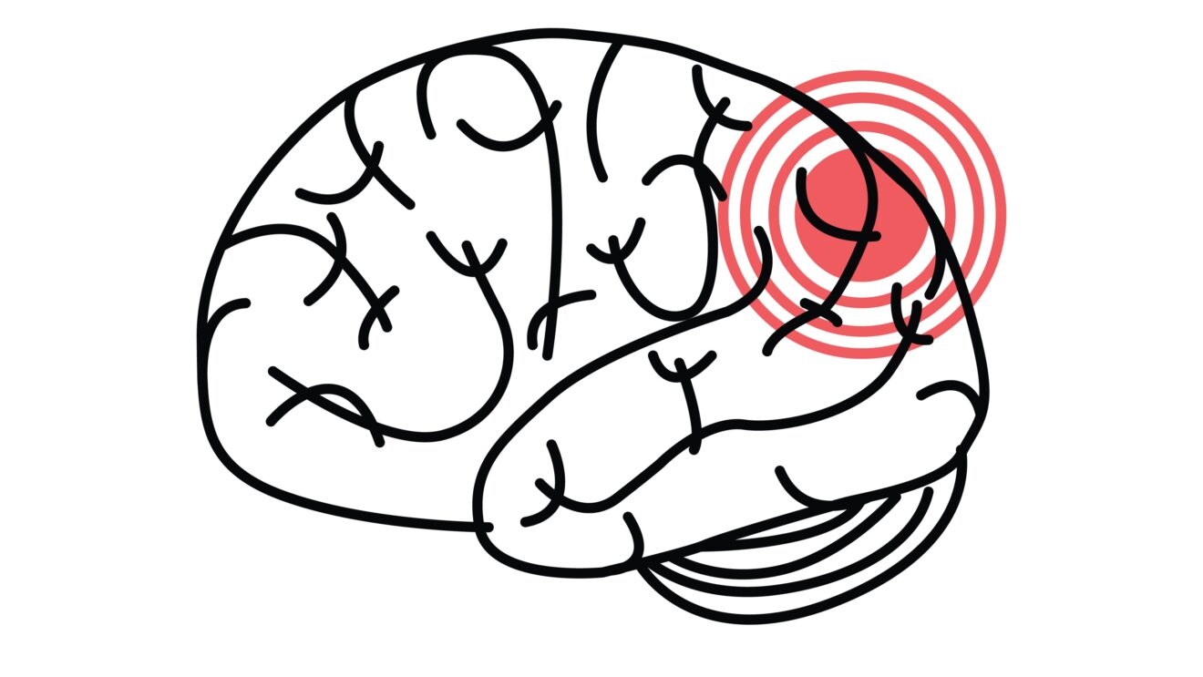 Equity in Pediatric Concussion Care
